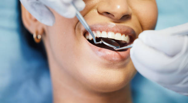 Best Emergency Dental Care for Abscessed Tooth in Velva, ND